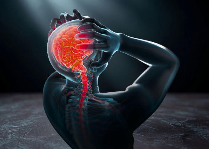 Stroke & Brain